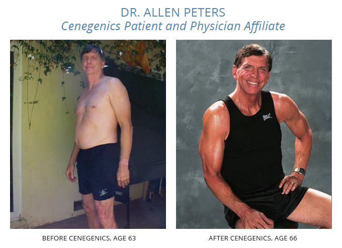 Dr. Allen Peters before and after going on the cenegenics program.